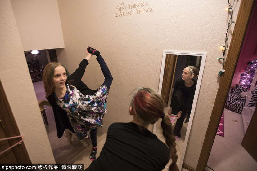 美國孿生連體姐妹分離手術(shù)后已茁壯成長11年