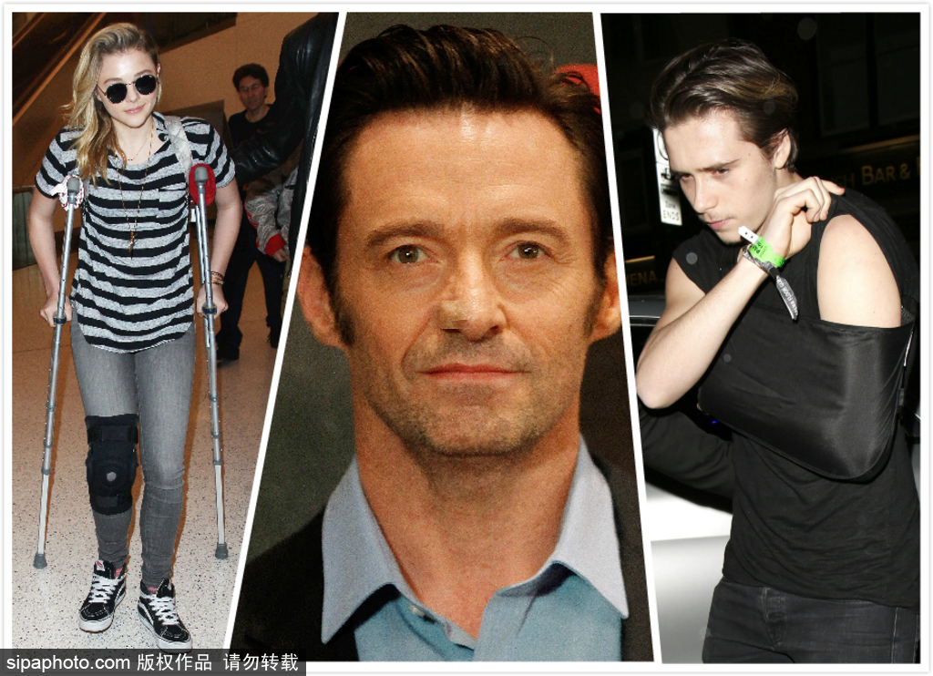 狼叔又患皮膚癌大布摔斷鎖骨 盤點帶傷亮相的明星