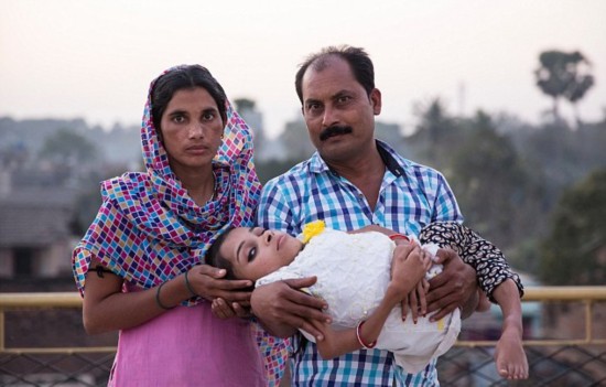 女孩患成骨不全骨癥 骨頭已碎裂1000次（圖）