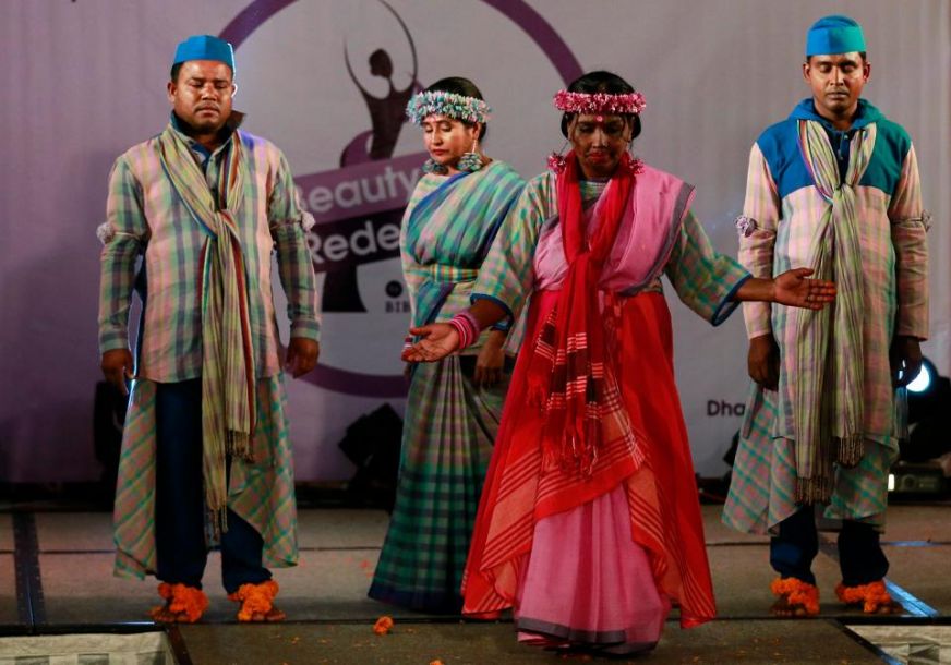 遭硫酸毀容女性走秀 重新定義美[組圖]