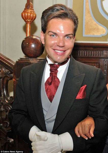 男子花300萬整容51次 破吉尼斯紀(jì)錄