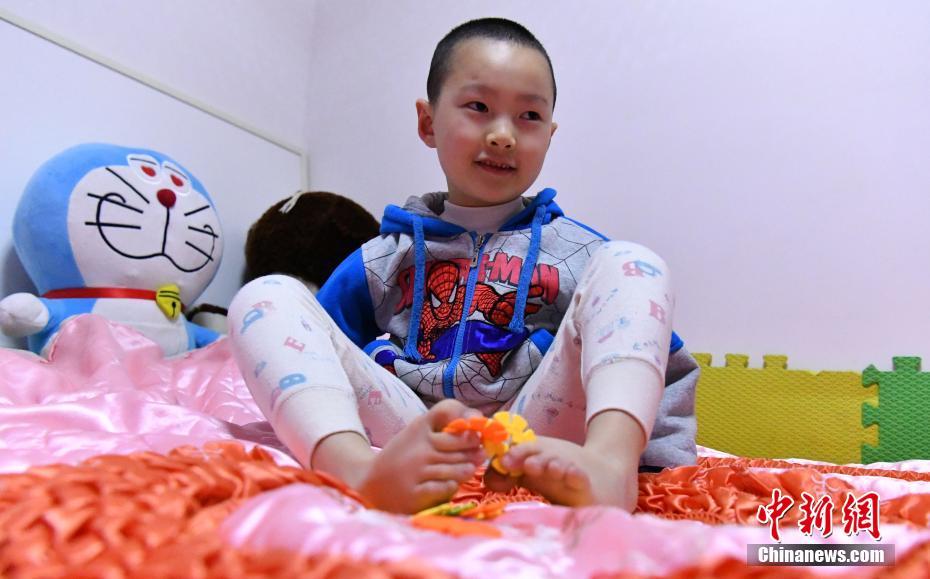 無臂男孩的快樂生活