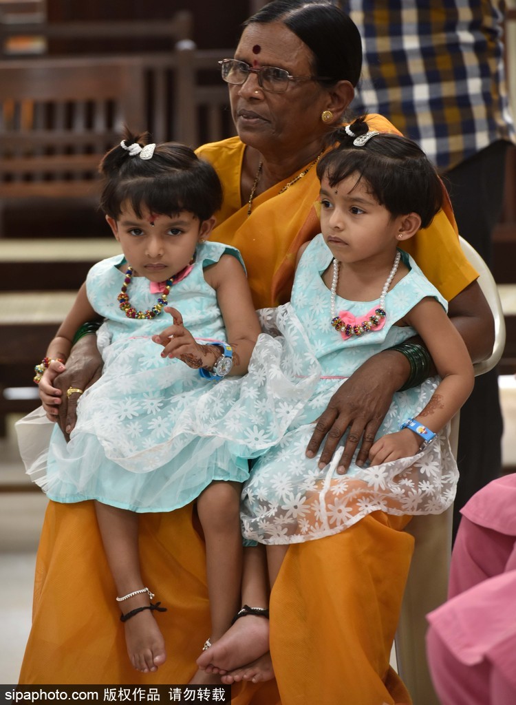 活下去就有希望 印度連體姐妹分離手術(shù)成功茁壯成長(zhǎng)